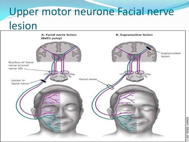 facial nerve upper motor Girl suduces fuck at formal